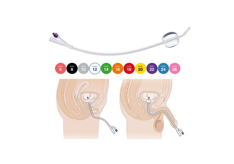 Катетер Фолея силіконовий, 2-ходовий “MEDICARE”, розмір Fr 24